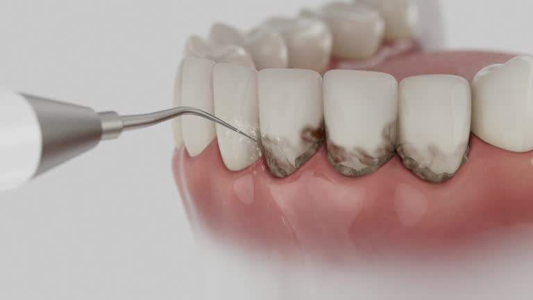 Reliable Dental Implants contractor in Redgranite, WI by Smile Center Dentistry